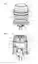 Fig. 03 - Sensor module, tissue processor, and method for operating a tissue processor