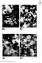 Fig. 05 - Method and Means for Detecting the Activity of Osteoclasts
