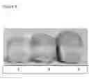 Fig. 09 - Enzymatic generation of functional lipids from cereals or cereal bi-streams