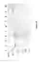 Fig. 08 - Polymerase Enhancing Factor (PEF) Extracts PEF Protein Complexes Isolated PEF Proteins and Methods for Purifying and Identifying