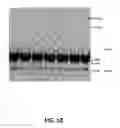 Fig. 11 - Polymerase Enhancing Factor (PEF) Extracts PEF Protein Complexes Isolated PEF Proteins and Methods for Purifying and Identifying