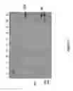 Fig. 27 - Polymerase Enhancing Factor (PEF) Extracts PEF Protein Complexes Isolated PEF Proteins and Methods for Purifying and Identifying