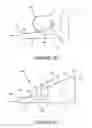 Fig. 05 - Foldable Prone Support