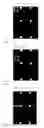 Fig. 03 - DNA CHIP, KIT FOR DETECTING OR GENOTYPING BACTERIA CAUSING SEXUALLY TRANSMITTED DISEASES, GENOTYPING ANTIBACTERIAL DRUG RESISTANCE AND DETECTING OR GENOTYPING METHOD USING THE SAME