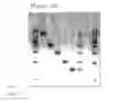 Fig. 10 - DNA CHIP, KIT FOR DETECTING OR GENOTYPING BACTERIA CAUSING SEXUALLY TRANSMITTED DISEASES, GENOTYPING ANTIBACTERIAL DRUG RESISTANCE AND DETECTING OR GENOTYPING METHOD USING THE SAME