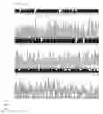Fig. 19 - DNA CHIP, KIT FOR DETECTING OR GENOTYPING BACTERIA CAUSING SEXUALLY TRANSMITTED DISEASES, GENOTYPING ANTIBACTERIAL DRUG RESISTANCE AND DETECTING OR GENOTYPING METHOD USING THE SAME