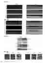 Fig. 14 - METHOD FOR THE DIAGNOSIS OF AGE-ASSOCIATED VASCULAR DISORDERS