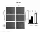 Fig. 19 - METHOD FOR THE DIAGNOSIS OF AGE-ASSOCIATED VASCULAR DISORDERS