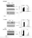 Fig. 22 - METHOD FOR THE DIAGNOSIS OF AGE-ASSOCIATED VASCULAR DISORDERS