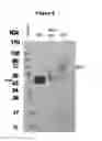 Fig. 05 - Biglycan mutants and related therapeutics and methods of use