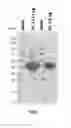 Fig. 07 - Biglycan mutants and related therapeutics and methods of use