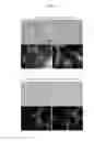 Fig. 14 - Biglycan mutants and related therapeutics and methods of use