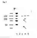 Fig. 04 - Means and methods for manufacturing highly pure neurotoxin