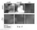 Fig. 05 - Cancer cell targeting using nanoparticles
