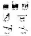 Fig. 04 - Method for treating ocular demodex