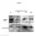 Fig. 04 - COMPOUNDS HAVING ACTIVITY IN CORRECTING MUTANT CFTR CELLULAR PROCESSING