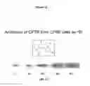 Fig. 14 - COMPOUNDS HAVING ACTIVITY IN CORRECTING MUTANT CFTR CELLULAR PROCESSING