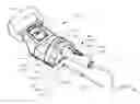 Fig. 01 - External adjustment device for distraction device