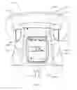 Fig. 03 - External adjustment device for distraction device