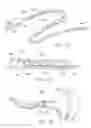 Fig. 13 - Rotate-to-advance catheterization system