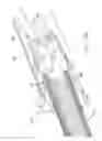 Fig. 20 - Rotate-to-advance catheterization system
