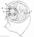 Fig. 01 - Devices and methods for tissue invagination