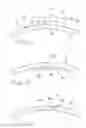 Fig. 03 - Surgical access apparatus and method