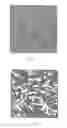 Fig. 04 - Diagnostic imaging support in which image data of high magnification is generated to image data of low magnification for classification thereof