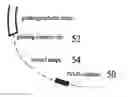 Fig. 01 - Optimization of multiple candidates in medical device or feature tracking