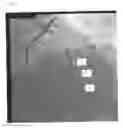 Fig. 05 - Co-use of endoluminal data and extraluminal imaging