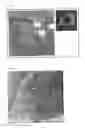 Fig. 08 - Co-use of endoluminal data and extraluminal imaging