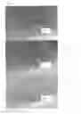 Fig. 12 - Co-use of endoluminal data and extraluminal imaging