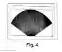 Fig. 05 - Ultrasound imaging system and methods of imaging using the same