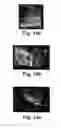 Fig. 15 - Ultrasound imaging system and methods of imaging using the same