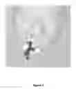 Fig. 04 - Surgery assistance system