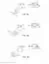 Fig. 15 - DELIVERY OF BIOLOGICAL COMPOUNDS TO ISCHEMIC AND/OR INFARCTED TISSUE