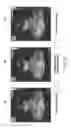 Fig. 04 - Method and system for ultrasound data processing