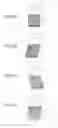 Fig. 04 - Ultrasonic diagnostic apparatus and storage medium
