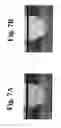 Fig. 08 - Dynamic motion contrast and transverse flow estimation using optical coherence tomography