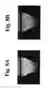 Fig. 09 - Dynamic motion contrast and transverse flow estimation using optical coherence tomography