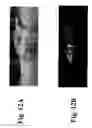 Fig. 13 - Dynamic motion contrast and transverse flow estimation using optical coherence tomography