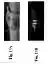 Fig. 14 - Dynamic motion contrast and transverse flow estimation using optical coherence tomography