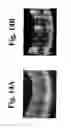 Fig. 15 - Dynamic motion contrast and transverse flow estimation using optical coherence tomography