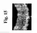 Fig. 16 - Dynamic motion contrast and transverse flow estimation using optical coherence tomography