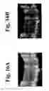 Fig. 17 - Dynamic motion contrast and transverse flow estimation using optical coherence tomography