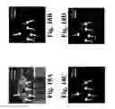Fig. 19 - Dynamic motion contrast and transverse flow estimation using optical coherence tomography