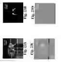 Fig. 24 - Dynamic motion contrast and transverse flow estimation using optical coherence tomography