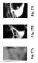 Fig. 28 - Dynamic motion contrast and transverse flow estimation using optical coherence tomography