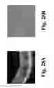 Fig. 29 - Dynamic motion contrast and transverse flow estimation using optical coherence tomography