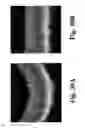 Fig. 31 - Dynamic motion contrast and transverse flow estimation using optical coherence tomography